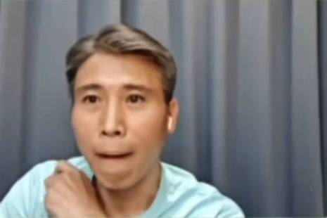 李乃文不耐受是什么意思