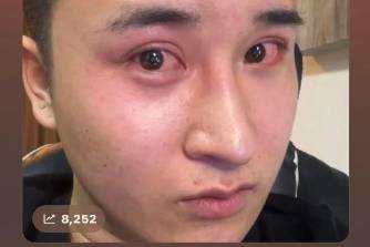 还我漂亮鼻子是什么意思