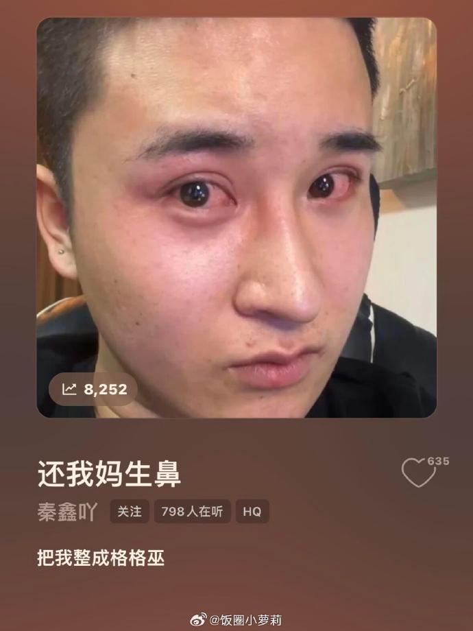 还我漂亮鼻子