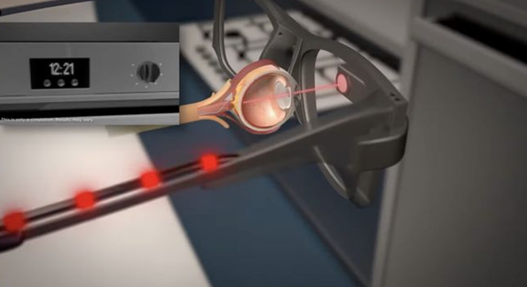 英国科研团队突破性人工视觉装置