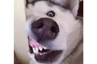 牙齿有点热是什么意思