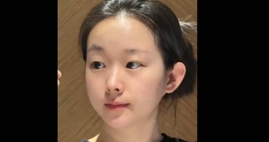 33岁职业女性因长相“逆龄”频遭误解，日常生活困扰不断