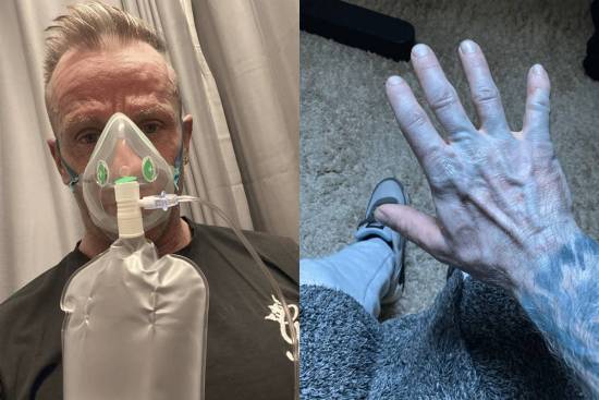 蓝肤色误判急送医,真相竟是床单掉色搞乌龙